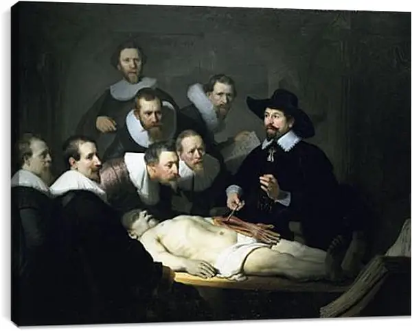 Постер на подрамнике - Die Anatomie des Dr Tulp. Рембрандт Постер на подрамнике - Die Anatomie des Dr Tulp. Рембрандт