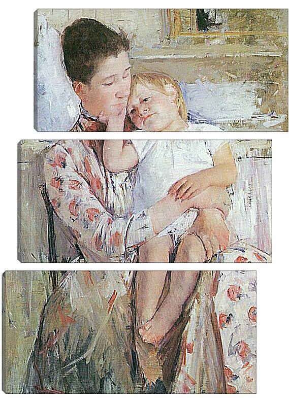 Модульная картина - Emmie and Her Child. Кэссетт (Кассатт) Мэри Стивенсон