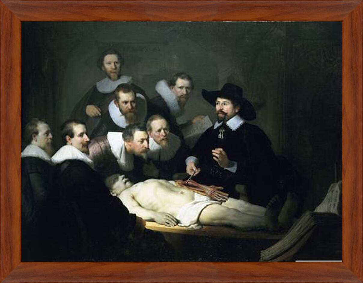 Картина в раме - Урок анатомии доктора Николаса Тульпа. Рембрандт