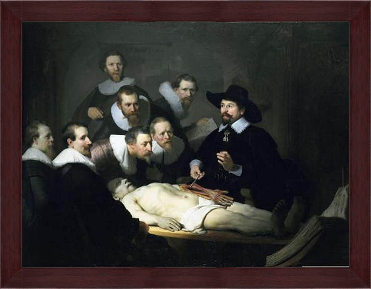 Картина в раме - Урок анатомии доктора Николаса Тульпа. Рембрандт
